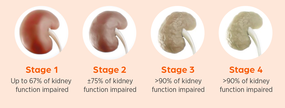 4 Stages of Renal Disease - Zoetis